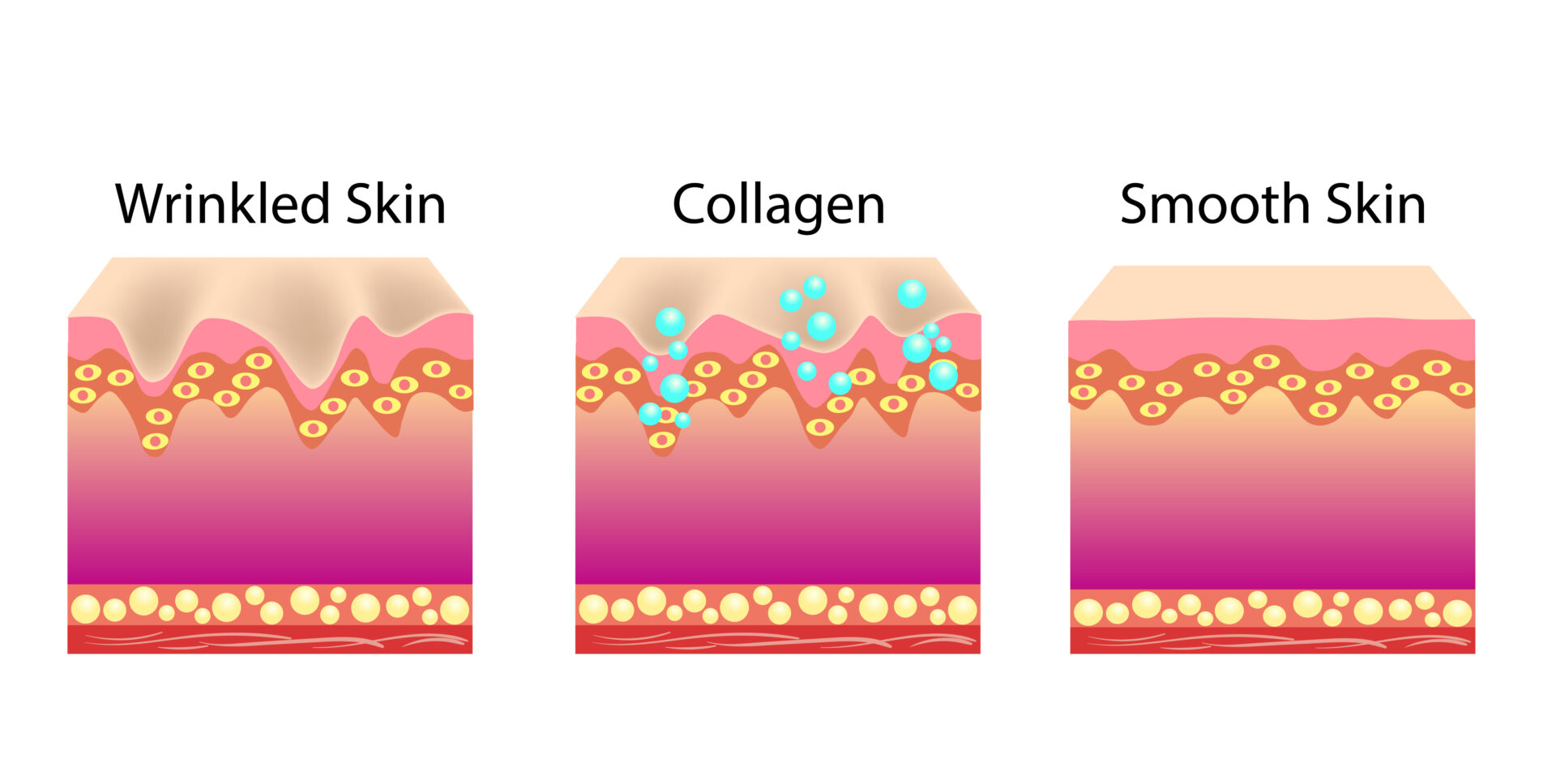 Vector illustration with process of getting skin skin younger with help of callogen isolated